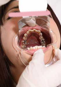 Teeth of Maiko