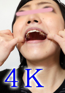遥ちゃんの歯　この黒いのは何ですか？　４K動画