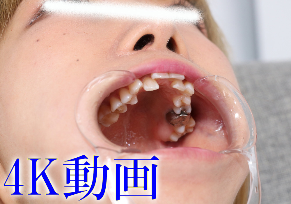 ナナちゃんの歯は伸びしろいっぱい！